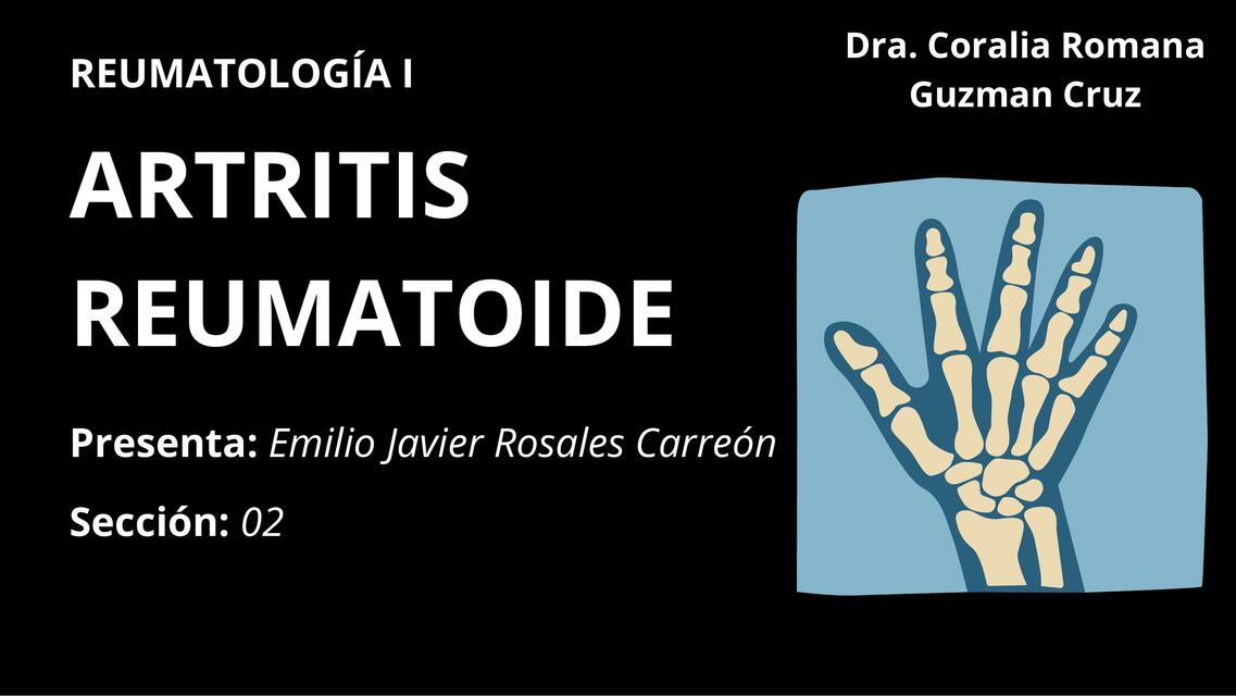 ARTRITIS REUMATOIDE