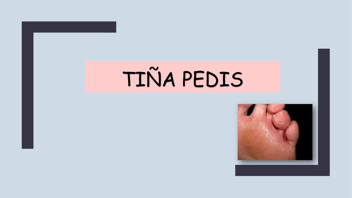 TIÑA PEDIS