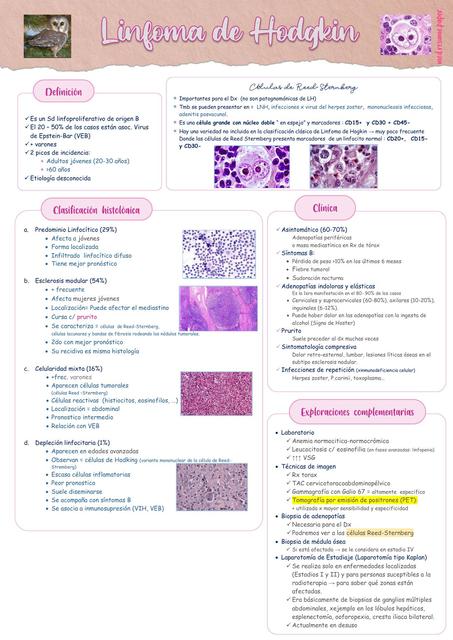 HEMATO Linfoma de Hodking