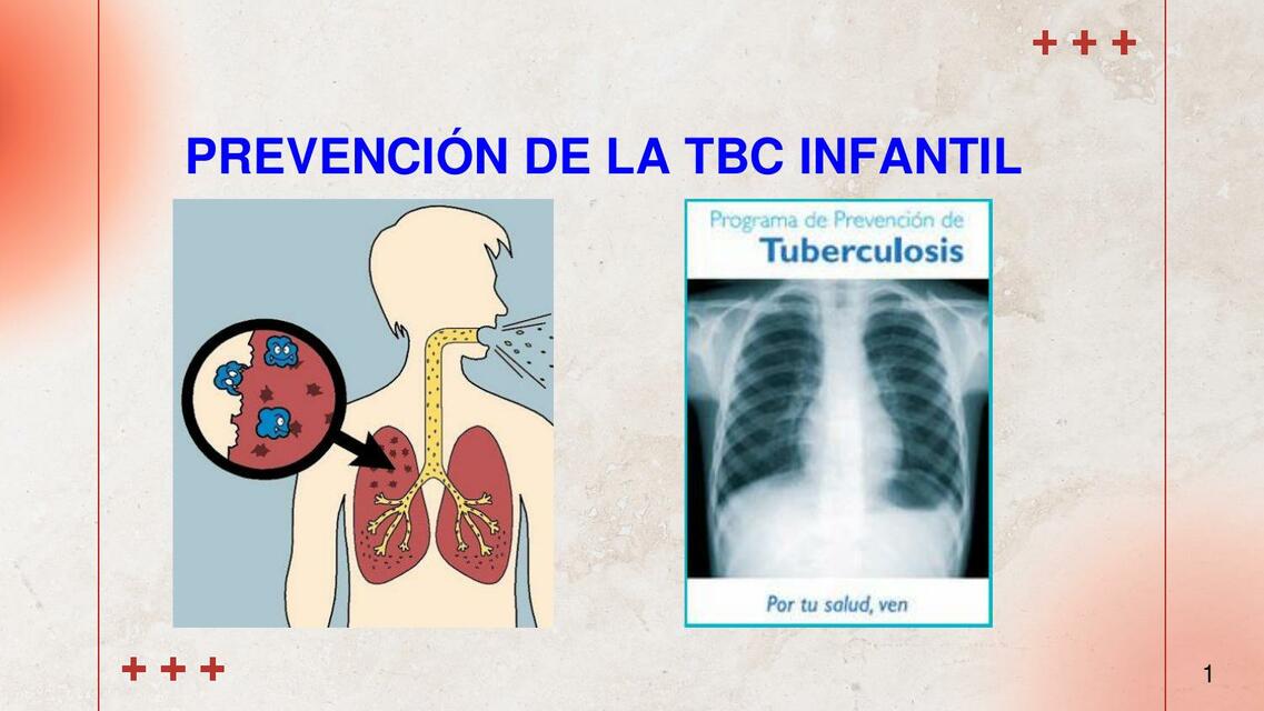 CLASE N 07 ASPECTOS PREVENTIVOS DE LA TUBERCULOSIS