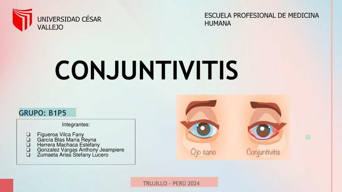 CONJUNTIVITIS