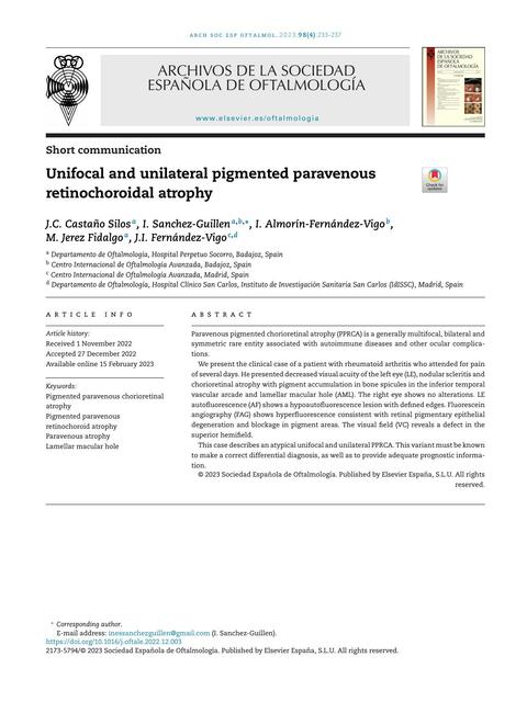 Unifocal and unilateral pigmented paravenous retin