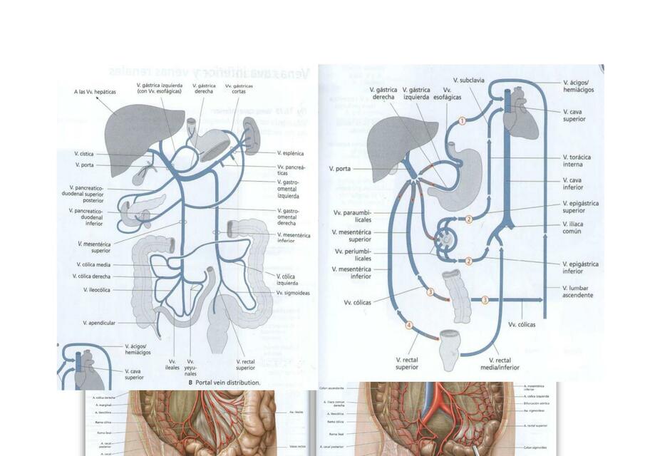 EXQUEMAS IRRIGACION ABDOMEN