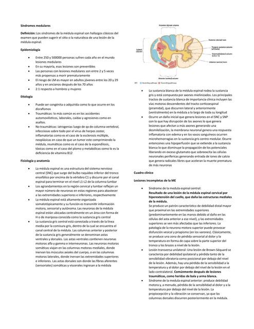 Síndromes medulares