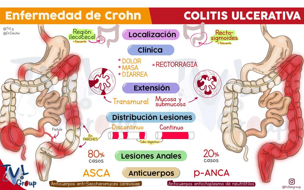 Enf Inflamatoria Intestinal