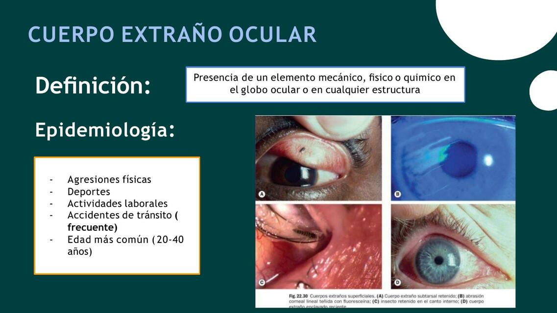 Cuerpo Extra o Ocular Lupita UDocz cuerpo-extra-o-ocular-lupita-udocz
