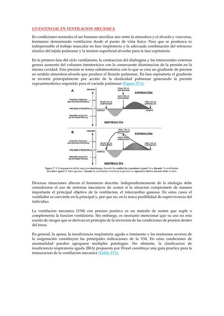 LO ESCENCIAL EN VENTILACION MECANICA PARA FISIOTERAPIA