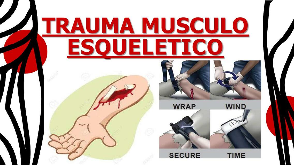 TRAUMA DEL MUSCULOESQUELETICO SBV