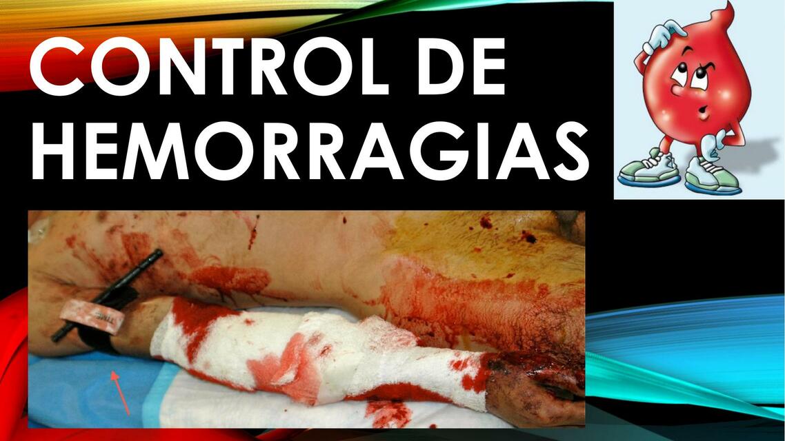 CONTROL DE HEMORRAGIAS