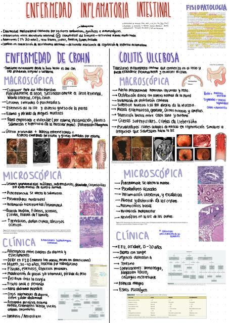 Enfermedad inflamatoria intestinal 