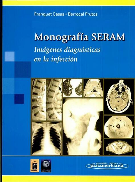 Imagenes diagnosticas de la infeccion