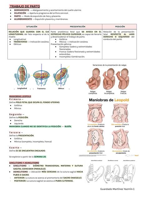 TRABAJO DE PARTO 1