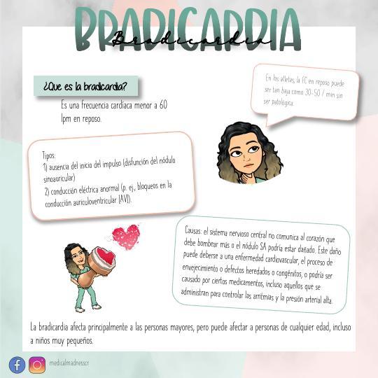 Bradicardias y Bloqueos Cardiacos 