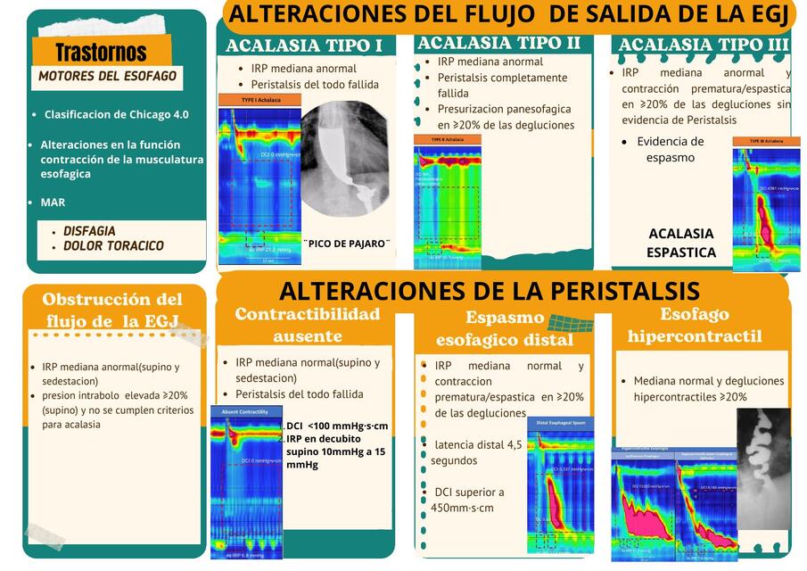 transtornos de la motilidad esofagica