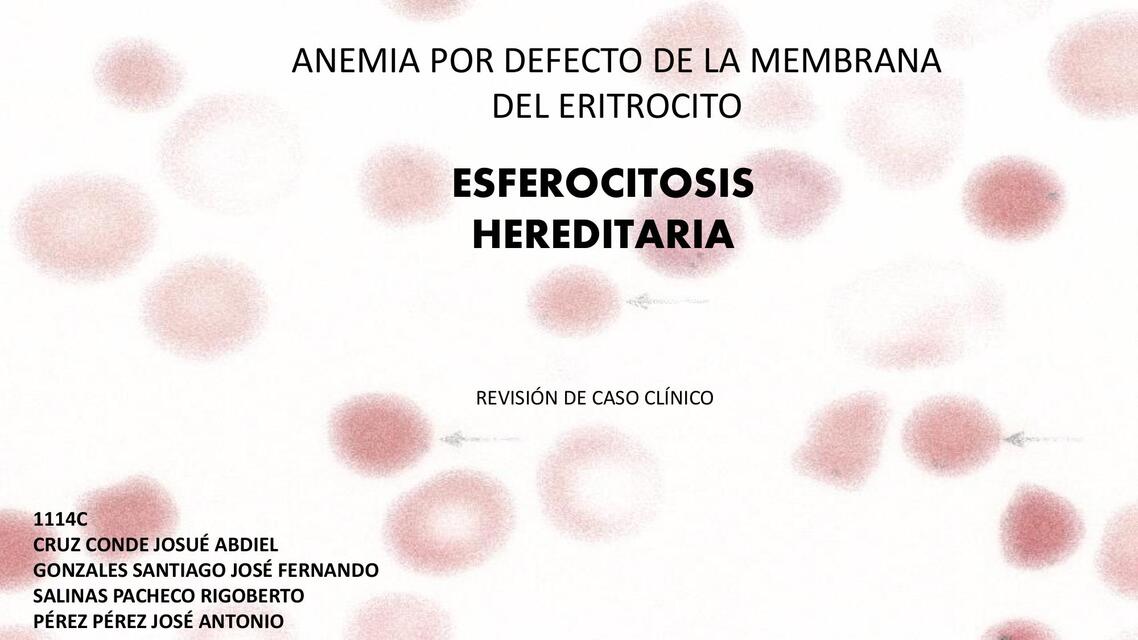 Anemia por deficiencia de membrana esferocitosis