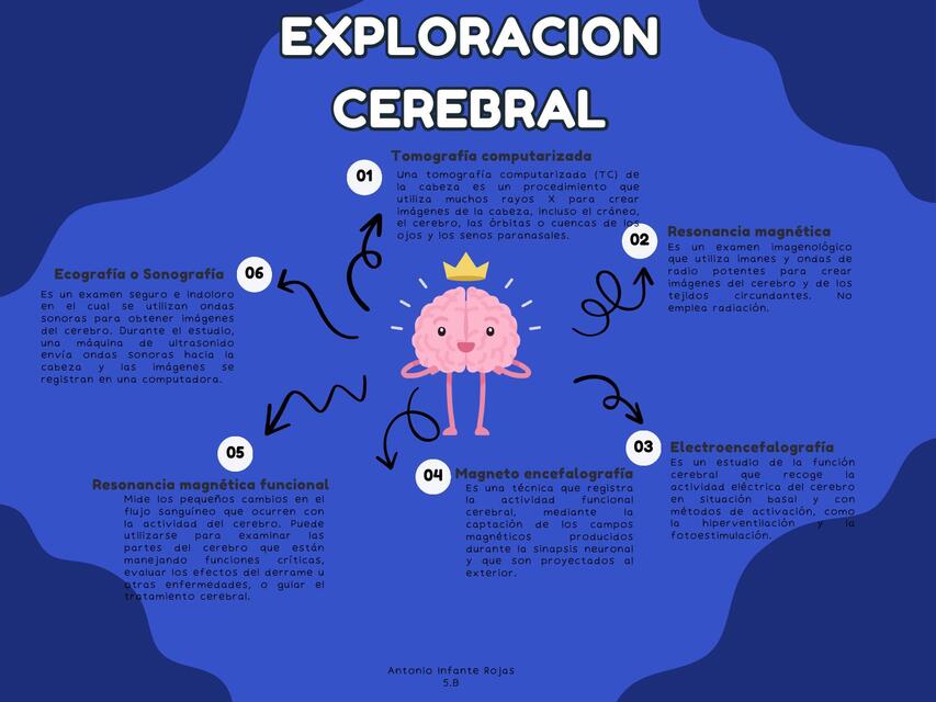 Exploración Cerebral