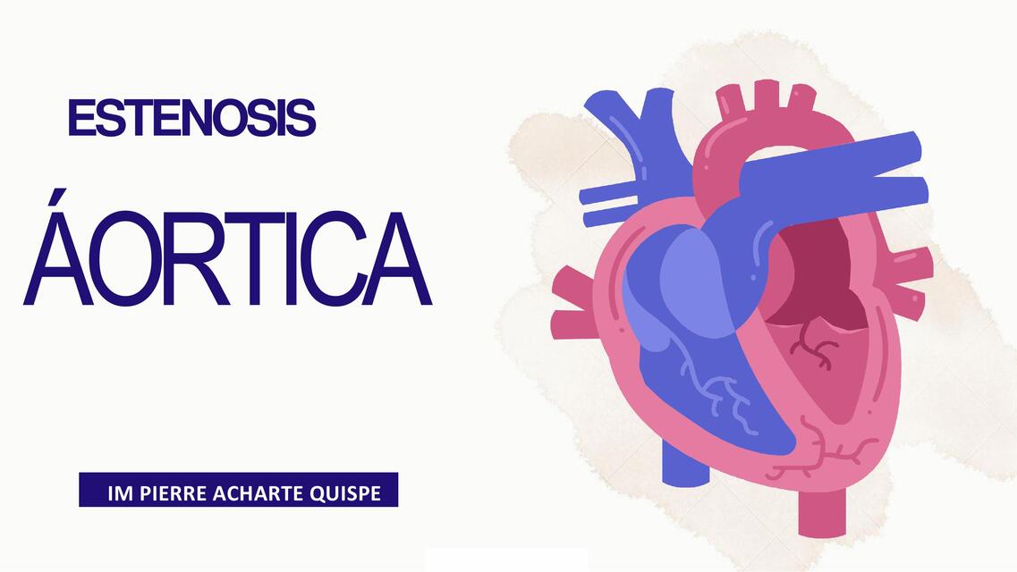 ESTENOSIS AORTICAPIERRE