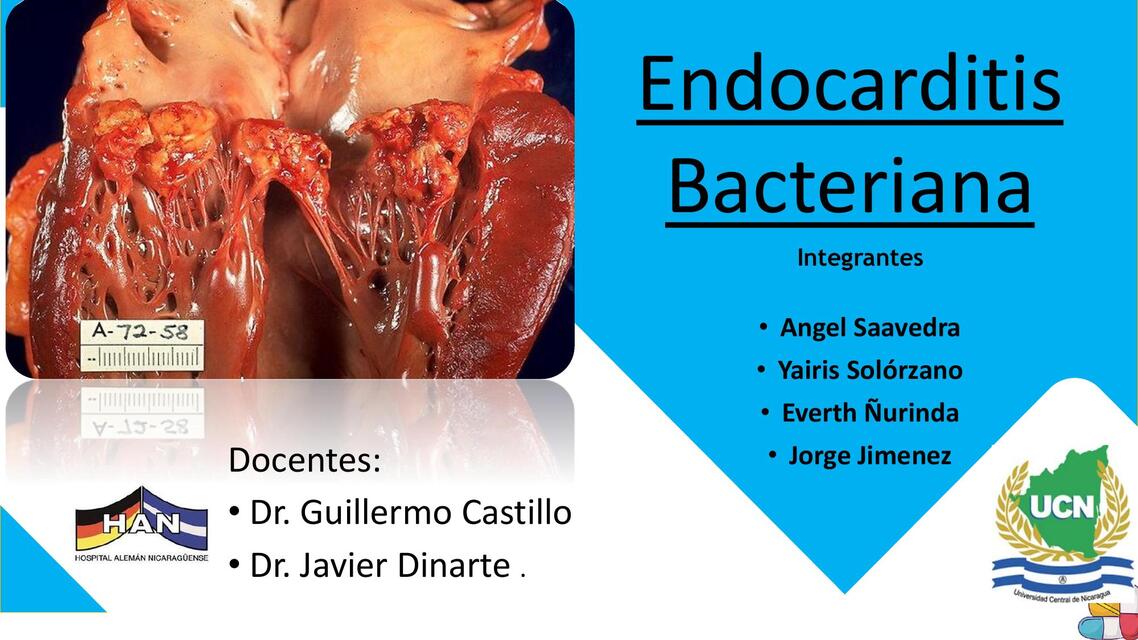 Endocarditis Infecciosa HAN 1