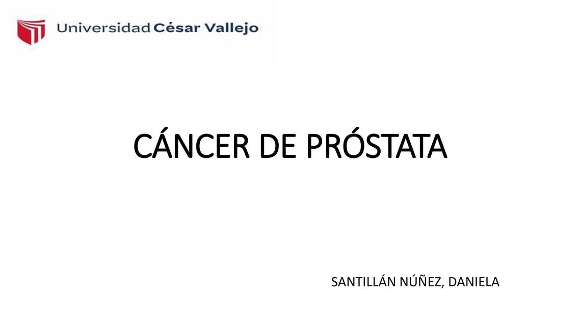 CÁNCER DE PRÓSTATA