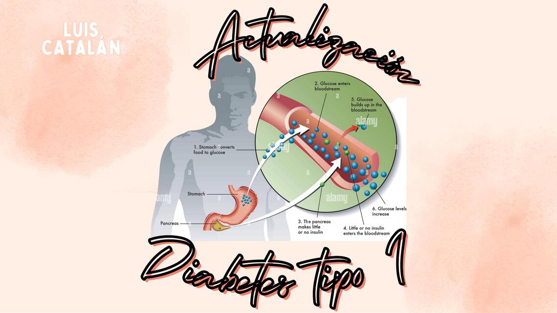 Actualización Diabetes tipo I