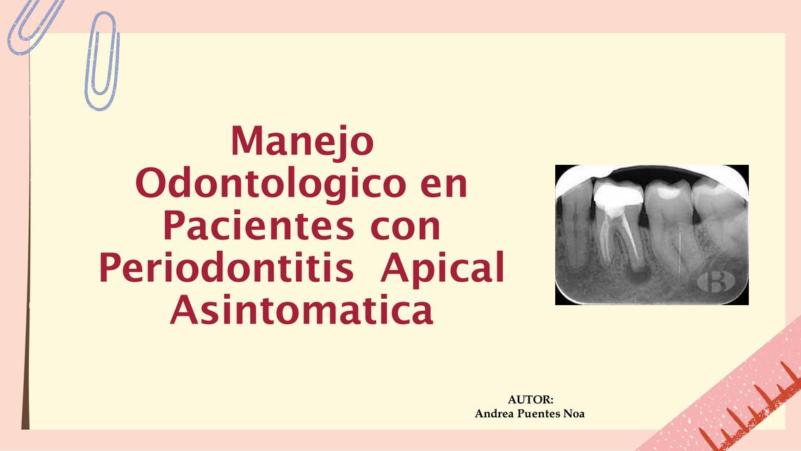 PERIODONTITIS APICAL ASINTOMATICA ENDODONCIA manejo clinico