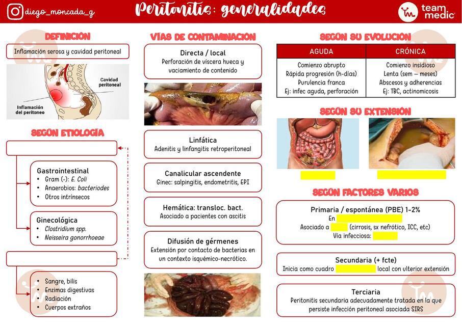 Peritonitis | Gianella QP | uDocz