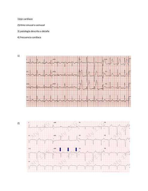 cardio examen