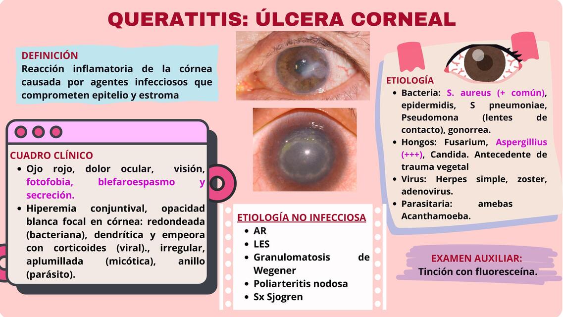 QUERATITIS