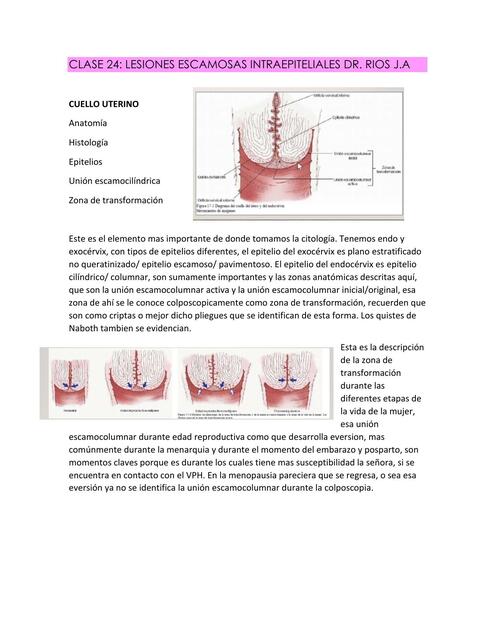 CLASE 24 LESIONES ESCAMOSAS INTRAEPITELIALES