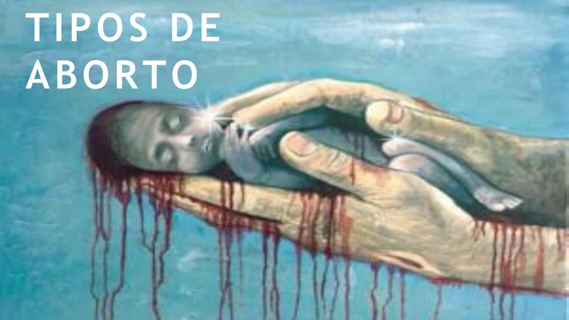 abortos