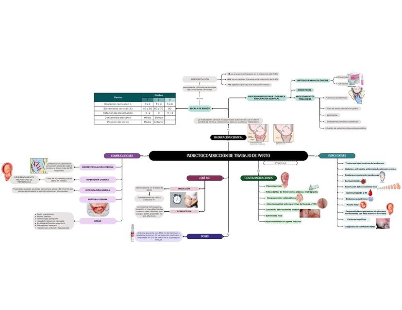 Mapa mental sobre inductoconducción del trabajo de parto