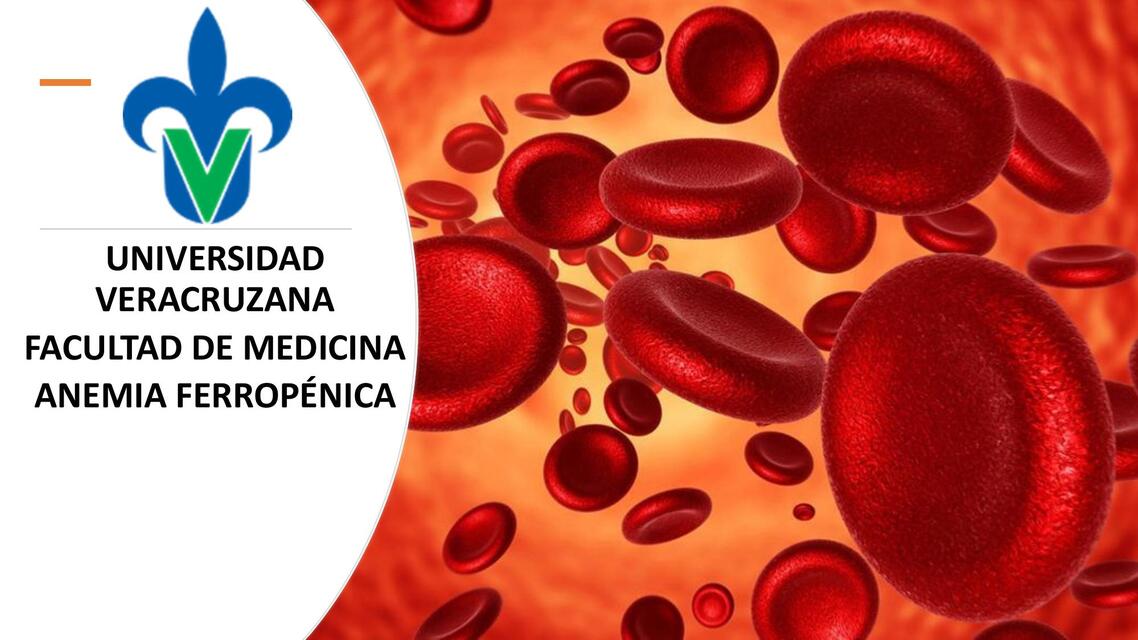 ANEMIA FERROPENICA URO