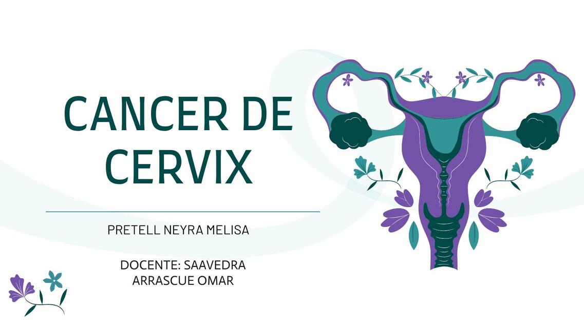 CANCER DE CERVIX