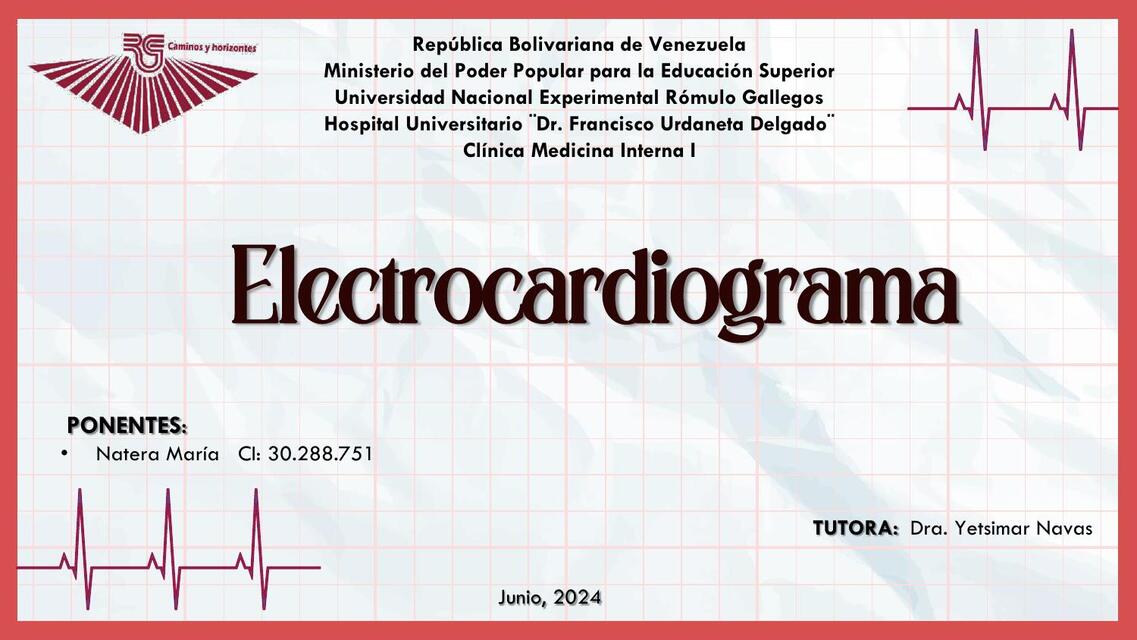 Diapositivas EKG