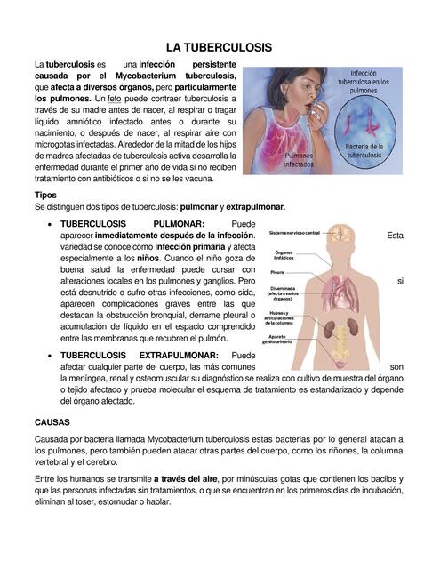 tuberculosis 1