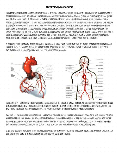 Enfermedad Coronaria
