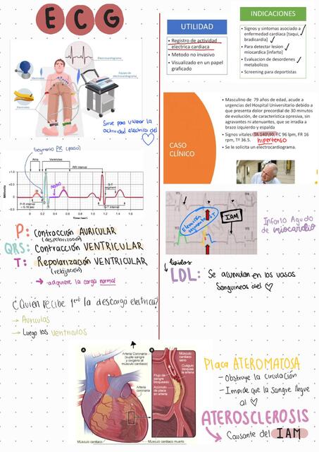 ECG