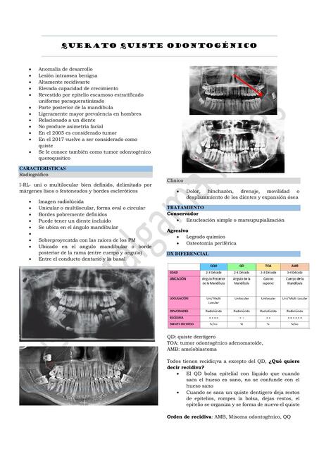 QUERATO QUISTE ODONTOGENICO