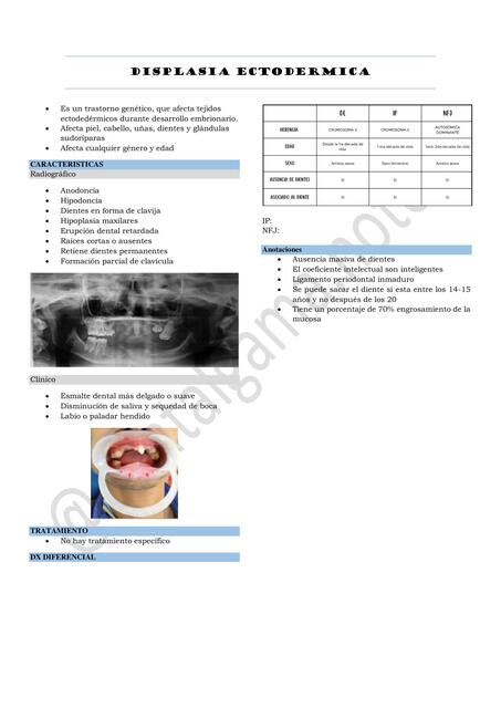 DISPLASIA ECTODERMICA