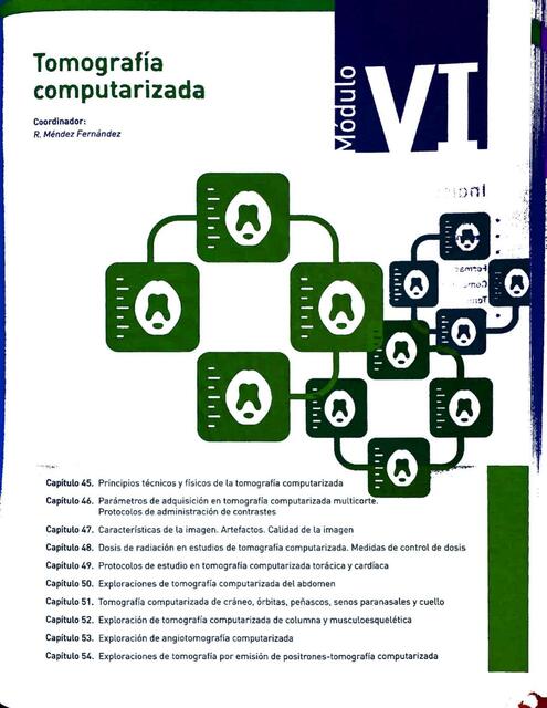 SERAM Tomografía computarizada