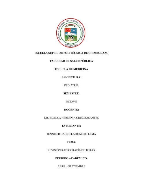 Radiografía de torax pediatria