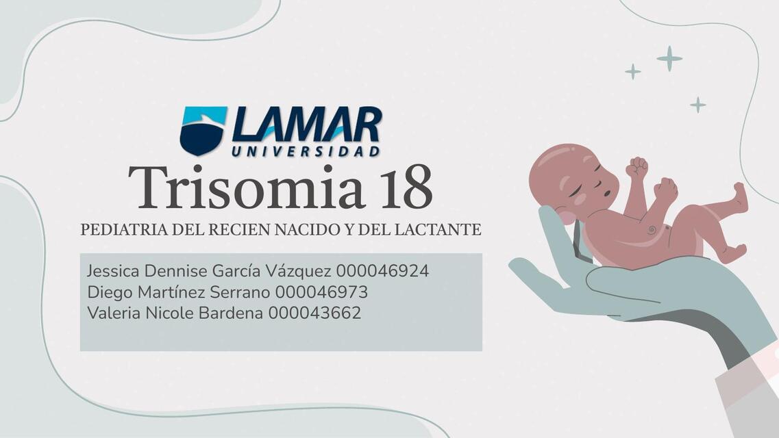 Trisomia 18