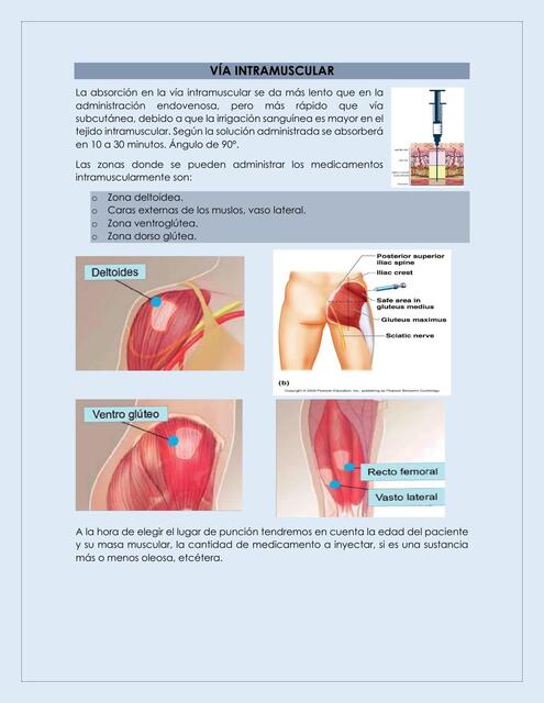 VÍA INTRAMUSCULAR clase