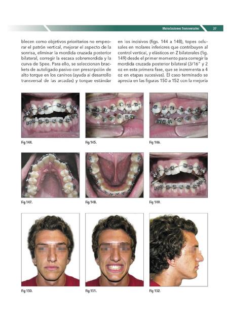 Manual de Ortopedia Dentofacial Tomo III 37