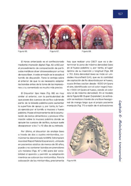 Manual de ortodoncia 157 scaled