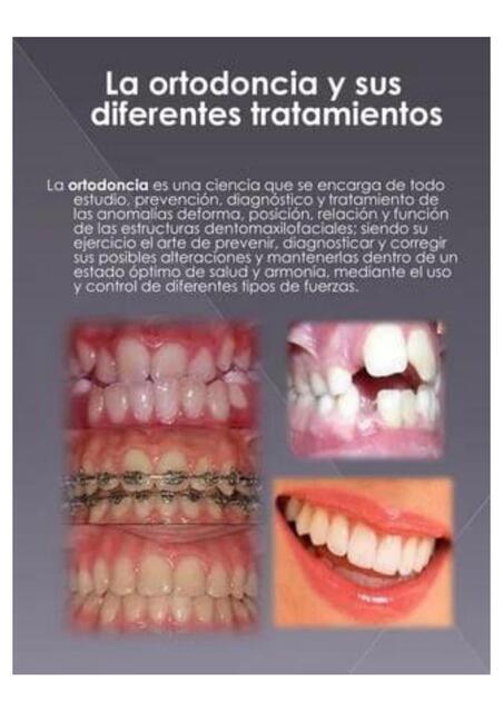 Diapositivas de ortodoncia 5 320