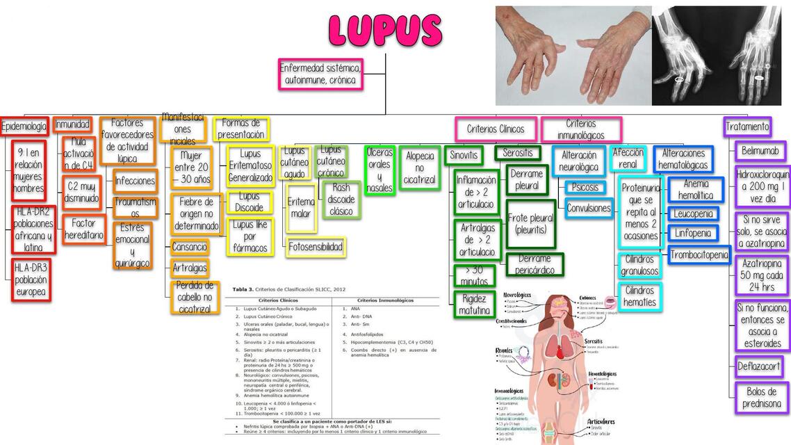 Lupus