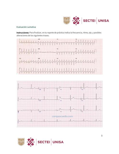 Trazos EKG