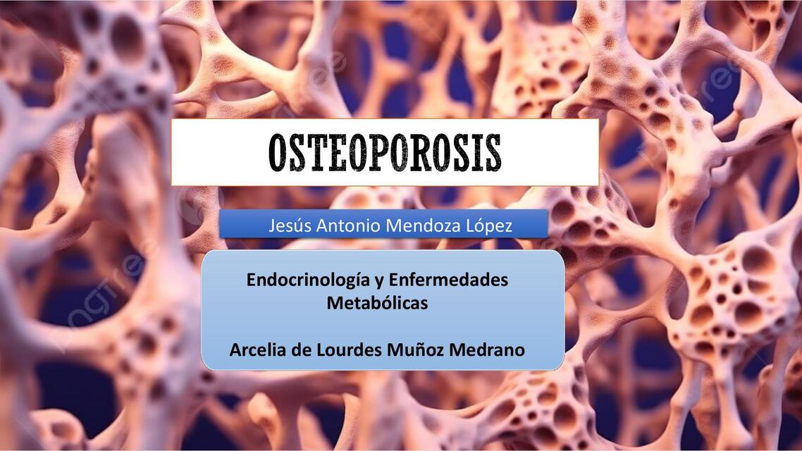 Endocrinologia Osteoporosis