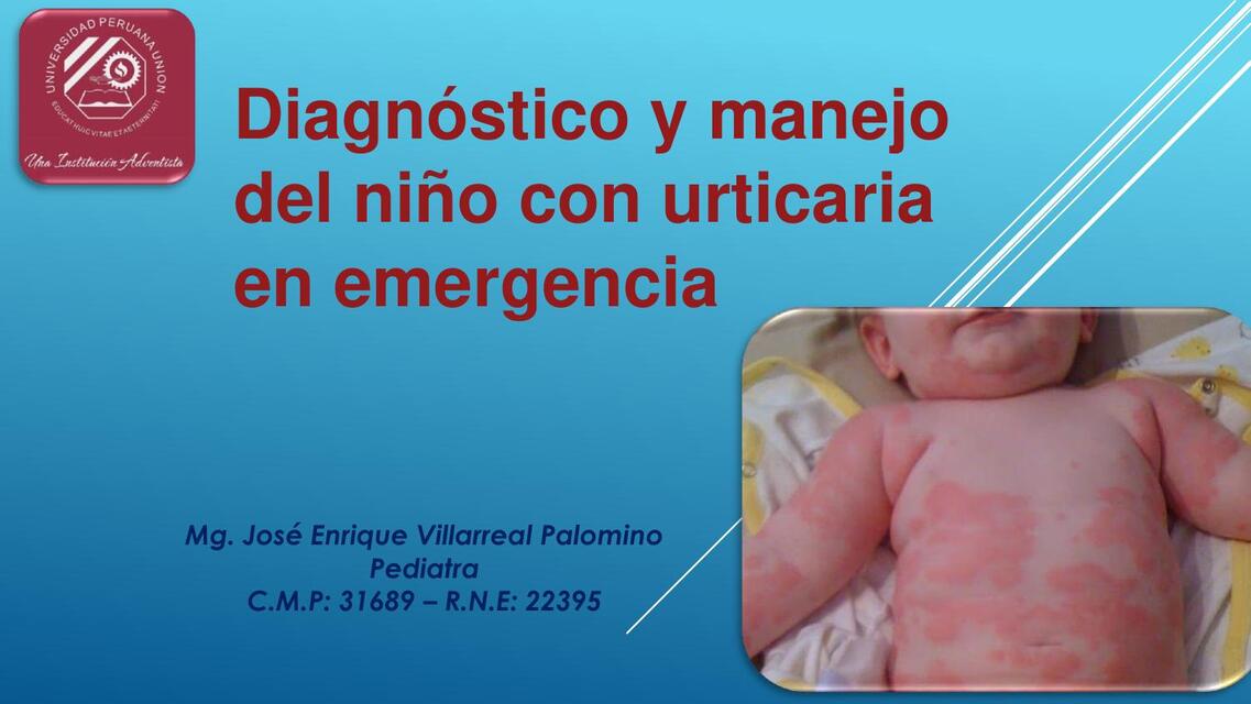 Diagnóstico y manejo del niño con urticaria en emergencia 